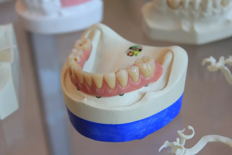 Implant-supported denture model used to explain All-on-4 dental implants in Fort Myers