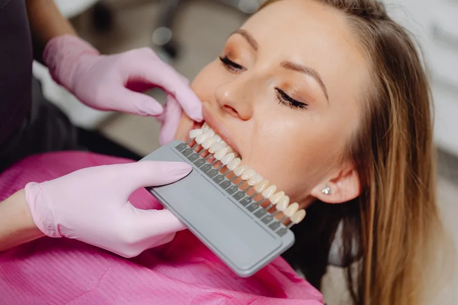 Dentist matching a whitening shade for a patient in Fort Myers